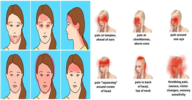 Here’s How To Determine Which Headaches Condition is Critical and Needs an Immediate Attention and Medication